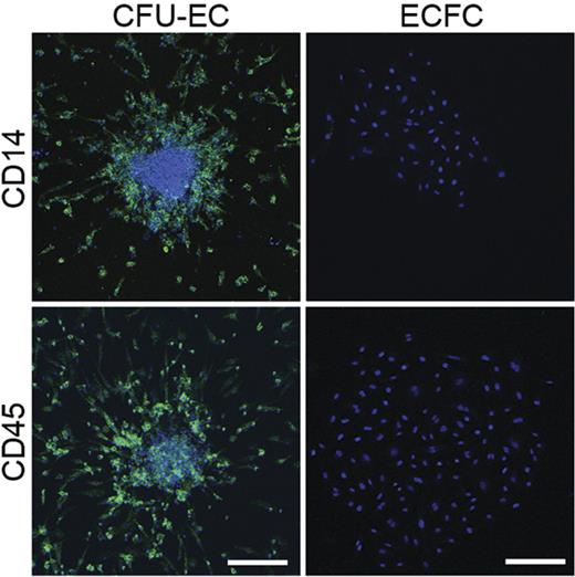 Figure 4. Expression of hematopoietic-specific cell surface antigens by CFU-ECs and ECFCs. Immunophenotyping of CFU-EC and ECFC colonies by confocal microscopy. CFU-ECs but not ECFCs express CD14 and CD45 (green). Photomicrographs are representative of 5 independent experiments using cells from different donors. Nuclei are stained with Hoechst 33342 (blue) and scale bar represents 200 μm.