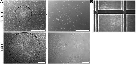 Figure 6. Secondary colony formation. (A) Representative phase-contrast photomicrographs of the cell progeny or secondary colonies (right) formed 7 days after primary CFU-EC and ECFC colonies (left) were plated at low cell density. Similar results were seen in 99 other CFU-EC colonies and 59 other ECFC colonies. Scale bar represents 500 μm. (B) Representative phase-contrast photomicrograph (original magnification, × 10) of secondary CFU-GM colonies formed 14 days after a primary CFU-EC colony was plated in a methylcellulose colony-forming assay. Primary ECFC colonies did not form CFU-GMs in the same assay (data not shown).