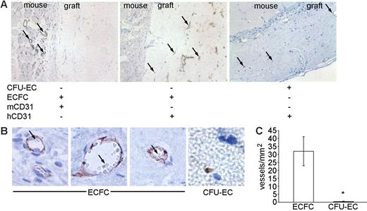 Figure 7. Transplantation of CFU-ECs and ECFCs into NOD/SCID mice. (A) Photomicrographs (original magnification, × 20) of cellularized grafts and surrounding murine tissue 28 days after implantation into NOD/SCID mice. Left and middle panels show consecutive sections of the same ECFC graft stained with anti–murine CD31 (mCD31) and anti–human CD31 (hCD31) to identify either murine or human blood vessels, respectively. mCD31 (left) does not cross-react with human endothelial cells within the graft and hCD31 (middle) does not cross-react with murine endothelial cells in the vessels outside the graft. Murine vessels were never identified in the cellularized graft (n = 18). Right panel shows a CFU-EC graft stained with anti–human CD31. Arrows indicate positive antigen staining. Results represent 9 other ECFC grafts and 2 other CFU-EC grafts. (B) Photomicrographs (original magnification, × 100) of ECFC and CFU-EC (far right) cellularized grafts stained with anti–human CD31 28 days after implantation. Vessels and capillaries in ECFC grafts are perfused with murine red blood cells (arrows) indicating anastomoses with murine blood vessels. CFU-EC grafts fail to form vessels or capillaries. Results represent 9 other ECFC grafts and 2 other CFU-EC grafts. (C) Quantitation of capillary density within ECFC (□) and CFU-EC (▪) cellularized grafts 28 days after implantation. Results represent the average number of capillaries containing murine red blood cells/mm2 of graft tissue ± SEM of 10 ECFC and 3 CFU-EC grafts. *P < .05 by Student unpaired t test.
