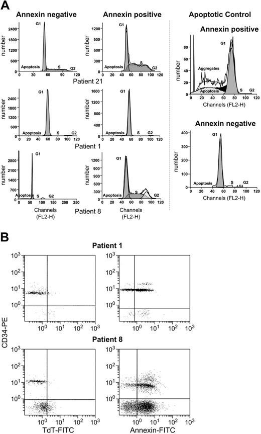 Figure 5. Absence of significant DNA degradation in annexin+ cells from patients with trisomy 8. (A) Cell-cycle analysis of sorted CD34 annexin+ and annexin− cells showed that trisomy 8 cells were more heavily represented in the annexin+ fraction, but no significant numbers of cells with subgenomic DNA could be seen in this fraction (full dataset in Table 1). (B) When purified CD34 cells were stained with annexin-PE and CD34-FITC, or the TUNEL assay performed, there was significant annexin staining, but few cells were TUNEL+ (full dataset in Table 1).