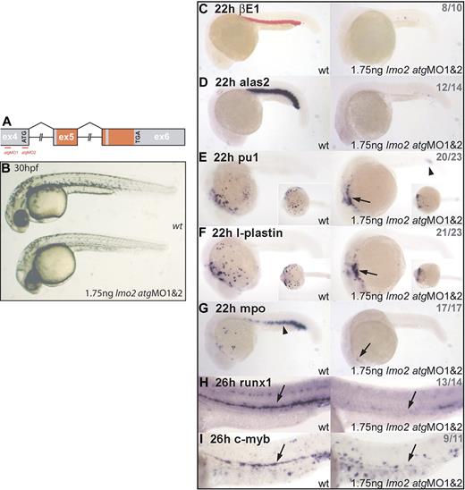Figure 1. Lmo2 morphants exhibit normal gross morphology but lack hematopoietic gene expression. (A) Genomic structure of the lmo2 gene. Exons (ex) depicted as boxes; atg start and tga stop codons are indicated; intron sizes not to scale; red-shaded regions encode the 2 LIM zinc finger–like domains (the first is split across exons 5 and 6); atgMO binding sites are shown (red lines). (B) Live 30-hpf embryos; lateral views; anterior, left. Lmo2 morphants developed without nonspecific defects. (C-G) Whole-mount embryos; lateral views; anterior, left; inset images in panels E and F show ventral view. (H-I) Whole-mount embryos; lateral view; close-up of trunk/tail region; anterior, left. Numbers of embryos represented in gray. (C-D) Erythroid, βE1, and alas2 expression is abolished in all morphants at 22 hpf. (E-G) In 22-hpf morphants, expression of primitive myeloid genes pu.1, l-plastin, and mpo was severely reduced. Remaining cells were restricted to the heart region (arrows) and, in the case of pu.1, the posterior ICM (arrowhead). (H-I) Expression of HSC markers runx1 and c-myb was significantly down-regulated in the ventral DA of Lmo2-depleted embryos (arrows).