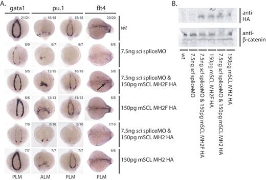 Figure 7. Lmo2 binding is required for early erythroid, myeloid, and endothelial gene expression. (A) Erythroid (gata1 and pu.1 in the PLM), myeloid (pu.1 in the ALM), and endothelial (flt4) gene expression defects in scl morphants can only be rescued by coinjection with an mRNA encoding a bHLH construct which includes the phenylalanine residue of the Scl second helix essential for the interaction between Scl and Lmo2. Whole-mount 15s embryos; views as indicated; numbers of embryos represented in gray. Arrow indicates rescued endothelial gene expression in the position of the dorsal aorta. (B) Western analysis shows that both HA-tagged constructs are expressed in injected whole-embryo extracts.