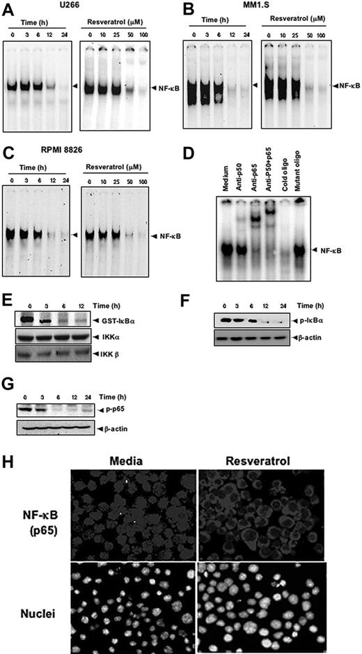 Figure 4. Resveratrol inhibits constitutively active NF-κB in MM cells. Resveratrol suppressed NF-κB in a time-dependent and a dose-dependent manner (A) in U266, (B) in MM1.S, and (C) RPMI 8826 cells. (A, left) U266 cells (2 × 106/mL) were treated with 50 μM resveratrol for 0, 3, 6, 12, and 24 hours and then tested for NF-κB by EMSA. (A, right) U266 cells (2 × 106/mL) were treated with the indicated concentrations of resveratrol for 24 hours and then tested for NF-κB by EMSA. (B, left) MM1.S cells (2 × 106/mL) were treated with 50 μM resveratrol for 0, 3, 6, 12, and 24 hours and then tested for NF-κB by EMSA. (B, right) MM1.S cells (2 × 106/mL) were treated with the indicated concentrations of resveratrol for 24 hours and then tested for NF-κB by EMSA. (C, left) RPMI 8826 cells (2 × 106/mL) were treated with 50 μM resveratrol for 0, 3, 6, 12, and 24 hours and then tested for NF-κB by EMSA. (C, right), RPMI 8826 cells (2 × 106/mL) were treated with the indicated concentrations of resveratrol for 24 hours and then tested for NF-κB by EMSA. (D) NF-κB DNA binding was specific, and the activated complex consisted of p50 and p65 subunits. The results shown are representative of 3 independent experiments. (E) To measure IKK activity, U266 cells (4 × 106/mL) were incubated with 50 μM resveratrol for the indicated times, after which whole-cell lysates were prepared and immunoprecipitated with an antibody against IKK-α and analyzed with an immunocomplex kinase assay. (Bottom) IKK protein levels were assessed by fractionating whole-cell extracts on SDS-PAGE and examining them with Western blot using anti-IKKα and anti-IKKβ antibodies. (F-G) To assess phosphorylation of IκBα (F) and p65 (G), U266 cells (2 × 106/mL) were treated with 50 μM resveratrol for indicated times and subjected to cytoplasmic fractionation. Then, 30-μg extracts were resolved on 7.5% SDS-PAGE gel and electrotransferred onto nitrocellulose membranes. The cytoplasmic fraction was probed for phospho-IκBα (F), and the nuclear fraction was probed for phospho-p65 (G). The same blots were stripped and reprobed with β-actin antibody to verify equal protein loading. (H) Resveratrol induced translocation of activated nuclear p65 from the nucleus to the cytoplasm. U266 cells (2 × 106/mL) were incubated with medium (left) or with 50 μM resveratrol (right) for 24 hours and then analyzed for the intracellular distribution of p65 by immunocytochemistry (original magnification ×200). The results shown are representative of 3 independent experiments.