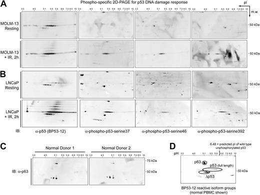 Figure 2. Characterization of p53 isoforms by 2D-PAGE immunoblotting. Phosphorylated p53 was detected by 2D-PAGE in resting and irradiated (A) Molm-13 and (B) LNCaP cells that express wild-type p53. Following IR, expression of total full-length p53 increased, a characteristic laddering was detected, and phosphorylation occurred at serines 37, 46, and 392, primarily in the full-length p53 isoform group. Following IR, no change in reactivity with phospho-specific antibodies was observed for p63 or Δp53 isoforms. (C) The 63-kDa isoform reactive with the BP53-12 antibody in normal PBMCs was p63. Also seen was a triplet of low-molecular-weight α-p63–reactive spots that were not detected by BP53-12. (D) p63, full-length p53, and the putative p53 truncation (designated Δp53) were the 3 major isoform groups reactive with BP53-12.
