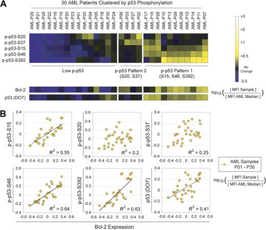 Figure 4. A coordinate profile of Bcl-2 expression, p53 expression, and p53 phosphorylation is observed in primary AML samples. (A) Expression of Bcl-2, p53, p-p53-ser15, p-p53-ser20, p-p53-ser37, p-p53-ser46, and p-p53-ser392 was measured for all 30 patient samples. Three clusters of p-p53 patterns were detected: low-phospho-p53; phosphorylation at serine 20 or 37; or phosphorylation at serine 15, 46, or 392. (B) Correlations between p53 phosphorylation and Bcl-2 expression were analyzed by linear regression. Data for each of 30 AML patient samples were plotted in 2 dimensions to determine dependence. Bcl-2 was significantly correlated with p53 phosphorylation at serines 15, 46, and 392.
