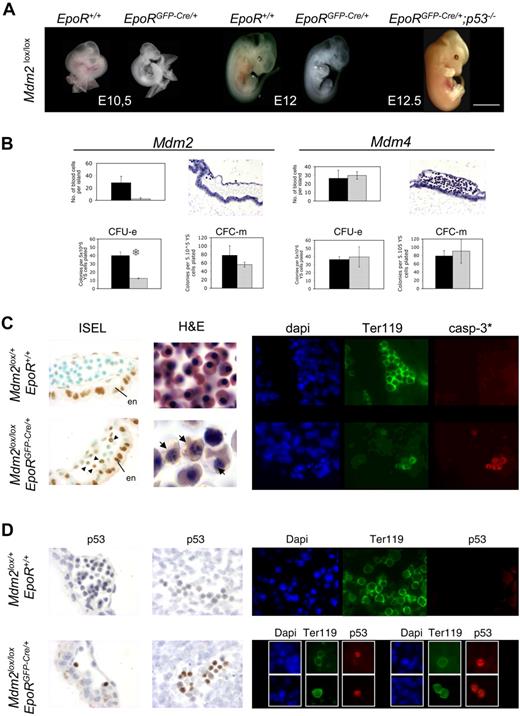 Figure 1. Mdm2, but not Mdm4, is required for primitive erythropoiesis. (A) Mdm2lox/lox embryos that are either positive (EpoRGFP-Cre/+) or negative (EpoR+/+) for the EpoR-GFP-cre transgene at various stages of embryonic development. Mdm2lox/lox; EpoRGFP-Cre/+ embryos are devoid of any red cells as early as E10.5, whereas E12.5 Mdm2lox/lox; EpoRGFP-Cre/+;p53−/− embryos appear normal. Scale bar equals 15 μm. (B) A representative blood island in sections of E10.5 Mdm2lox/lox and Mdm4lox/lox ; EpoRGFP-Cre/+ embryos (top panels). The presence of blood cells is severely compromised in Mdm2lox/lox mutants. Data from controls (Mdm2lox/+ or Mdm4lox/+; EpoR+/+) and mutants are represented by the black and gray bars, respectively. The yolk sac sections are stained with hematoxylin and eosin. Magnification, × 20. Number of CFU-Es and monocyte-macrophage colony-forming cells (CFC-m's) detected in methylcellulose cultures supplemented with Epo or a mixture of interleukin-3 (IL-3), IL-6, and stem cell factor (SCF), respectively (bottom panels). Numbers are expressed per 5 × 105 yolk sac cells. Data from controls (Mdm2lox/+ or Mdm4lox/+; EpoR+/+) and mutants are represented by the black and gray bars, respectively. The data represent the means (± SD) of 6 independent experiments. There is a significant difference between the mean numbers of CFU-Es in the mdm2 mutants compared with their control littermates by the Student test (P < .001; S). (C) Mdm2 inactivation in erythroid progenitors leads to apoptotic cell death. In situ end labeling (ISEL) in blood islands of E10.5 embryos with the indicated genotypes (left panels). Note that strong background staining is observed in the visceral endoderm (en) of both control and mutant embryos. Within the blood islands, specific staining is only observed in sections from Mdm2lox/lox; EpoRGFP-cre/+ embryos (arrowheads). Hematoxylin and eosin–stained sections of heart from E12 fetuses (middle panels). In contrast to controls, only a few nucleated erythrocytes were found in Mdm2lox/lox; EpoRGFP-Cre/+ sections, and many apoptotic figures are seen (arrows). Magnification, ×100. Cleaved caspase-3 expression (casp-3*; red) in Ter119-positive erythroid progenitors (green) in the dorsal aorta of embryos with the indicated genotypes (right panels). DNA (blue) is stained with 4,6-diamidino-2-phenylindole (dapi). Magnification, ×40. (D) Mdm2 inactivation in erythroid progenitor cells leads to increased p53 protein levels. Immunohistochemistry for p53 in the blood islands (left panels) and the dorsal aorta (middle panels) and immunohistofluorescence for p53 and Ter-119 in the heart (right panels) of embryos with the indicated genotypes. p53 expression is only detected in the nuclei of most (> 90%) erythroid cells of Mdm2lox/lox; EpoRGFP-Cre/+ embryos. DNA (blue) is stained with dapi. Magnification, ×40.