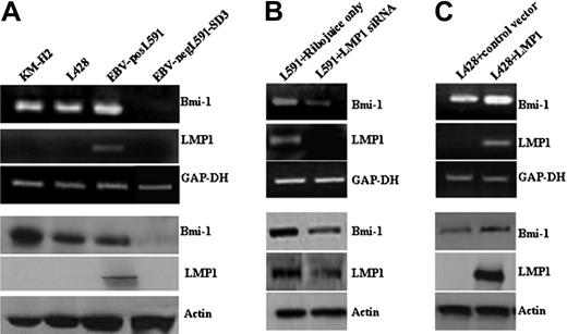 Figure 1. LMP1 induces Bmi-1 expression in HL cells. (A) Expression of Bmi-1 in EBV-negative HL cell lines L428 and KMH2 and in the EBV-positive (LMP1-positive) L591 HL cell line compared with the EBV-negative variant, L591-SD3. Although Bmi-1 is highly expressed in all parental lines, irrespective of EBV status, loss of the EBV episome from L591 cells resulted in its down-regulation (for all figures, mRNA and protein are shown in upper and lower panels, respectively). (B) Knockdown of LMP1 expression (L591+LMP1 siRNA) down-regulates Bmi-1 expression in EBV-positive L591 cells compared with cells treated with transfection reagent (RiboJuice; Novagen) alone. (C) Ectopic expression of LMP1 in EBV-negative L428 cells up-regulates Bmi-1 expression.