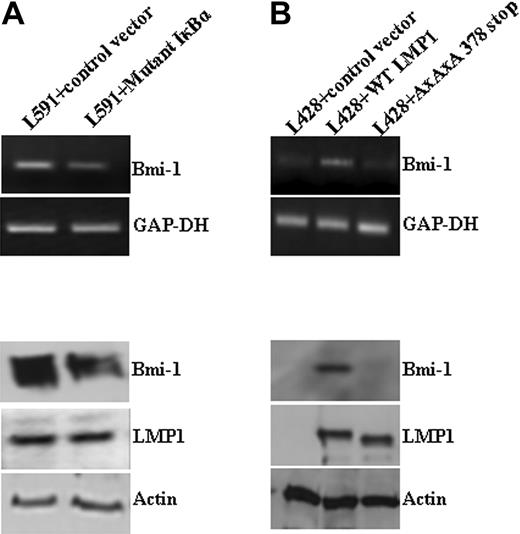 Figure 2. LMP1 induction of Bmi-1 is NF-κB dependent. (A) L591 cells transfected with a plasmid expressing an IκBκ mutant that inhibits NF-κB activation. Expression of the IκBκ mutant resulted in the down-regulation of Bmi-1 expression compared with cells transfected with control vector. (B) L428 cells transfected with control plasmid (empty vector), wild-type (wt) LMP1, or a mutant LMP1 incapable of inducing NFκB (AxAxA378stop). WtLMP1, but not AxAxA378stopLMP1, induced Bmi-1 expression.