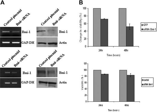 Figure 4. Bmi-1 promotes the survival of HL cells. (A) Knockdown of Bmi-1 expression in L591 cells (top) and in L428 cells (bottom). mRNA and protein are shown in the left and right panels, respectively. (B) Knockdown of Bmi-1 led to a marked reduction in the viability of L591 cells (upper) at 24 hours and at 48 hours after transfection compared with control cells (GFP-only vector). Knockdown of Bmi-1 in L428 cells had a significant but less marked effect on cell viability (bottom). Error bars represent the standard error of the mean.