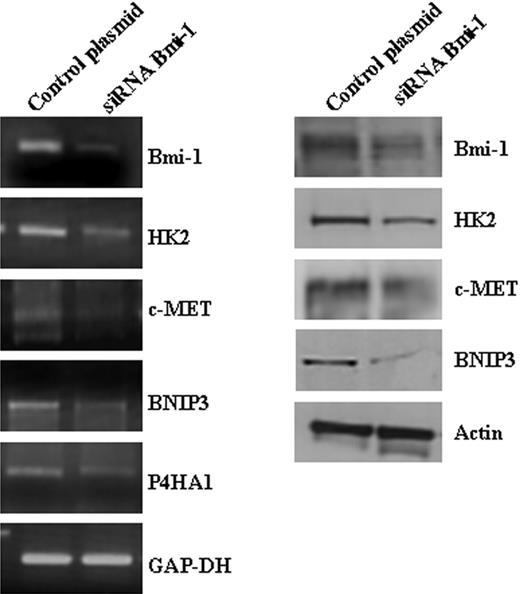 Figure 5. Validation of Bmi-1 target genes identified by microarray analysis. Knockdown of Bmi-1 expression in L428 cells resulted in the down-regulation of HK2, c-MET, BNIP3, and P4HA1 mRNA (left). Changes in the protein levels of HK2, c-MET, and BNIP3 were also demonstrated (right). P4HA1 could not be confirmed at the protein level because of the lack of a suitable antibody.