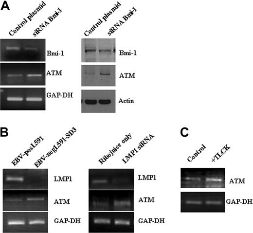 Figure 7. Bmi-1 and LMP1 down-regulate expression of the ATM tumor suppressor in HL cells. (A) Knockdown of Bmi-1 expression in L428 cells resulted in the up-regulation of ATM expression. (left) Changes in mRNA. (right) Changes in protein. Knockdown of Bmi-1 in the KM-H2 cell line produced similar effects on ATM expression (data not shown). (B) ATM expression was higher in EBV-negative L591 cells than in EBV-positive L591 cells (left). Knockdown of LMP1 in EBV-positive L591 cells led to the up-regulation of ATM transcription (right). These data show that ATM expression is suppressed by LMP1 in EBV-positive HL cells. (C) Inhibition of NF-κB in L428 and cells up-regulated ATM expression. Similar effects were also observed in KM-H2 cells (data not shown).
