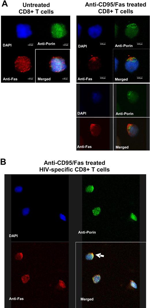 Figure 7. CD95/Fas and mitochondria copolarization in early steps of CD95/Fas-induced apoptosis of HIV-specific CD8+ T cells. (A) Purified CD8+ T cells from an HIV+ individual were left untreated or treated with a mouse anti-CD95/Fas antibody for 1 hour at 37°C. Following fixation, a double-staining protocol was performed. Localization of CD95/Fas and mitochondria was analyzed by confocal microscopy. Representative 3D images are shown from 1 of 3 experiments performed. Untreated cells are shown on the left; right panels depict 2 cells showing copolarization. (B) Representative 3D confocal image showing CD95/Fas and mitochondria localization in sorted HIV-specific CD8+ T cells treated with anti-CD95/Fas antibody. CD95/Fas capping is accompanied with copolarization of mitochondria (arrow).