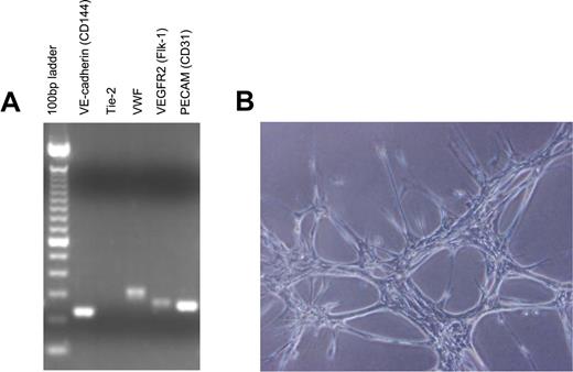 Figure 1. MBECs express endothelial-specific genes and display endothelial functional characteristics. (A) Primarily passaged MBECs were collected, and total RNA was isolated and prepared for reverse-transcriptase PCR analysis for expression of multiple endothelial cell genes. VE-cadherin, VWF, VEGFR-2, and PECAM (CD31) were all expressed by MBECs, confirming their endothelial cell lineage. (B) Primary MBECs (5 × 104) were plated in 24-well tissue culture plates precoated with Matrigel to analyze for evidence of capillary tube forming capability. As shown, MBECs readily formed tubelike structures, consistent with an endothelial cell lineage.