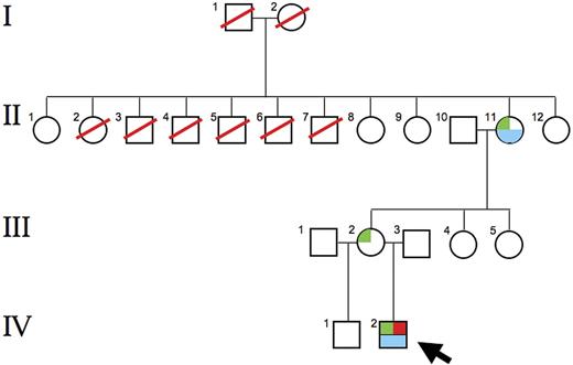 Figure 3. Pedigree of the proband. The R216W GATA1 mutation was found in the proband (IV-2; ←), his mother (III-2), and his maternal grandmother (II-11). Marked anemia and 60% Hb F were found in the proband; a moderate anemia and 4.8% Hb F were found in the grandmother. Both the proband and his grandmother were thrombocytopenic. The grandmother was 1 of 11 siblings, including 5 brothers, and none were known to be anemic. Siblings II-8, II-9, and II-12 collectively had 7 sons (not shown). None were known to be anemic, and none had signs or symptoms of CEP. These findings suggest that the R216W mutation is a new mutation arising in the maternal grandmother. Green box indicates R216W GATA1 mutation; red box, porphyric phenotype; blue box, anemia, thrombocytopenia and high Hb F levels.