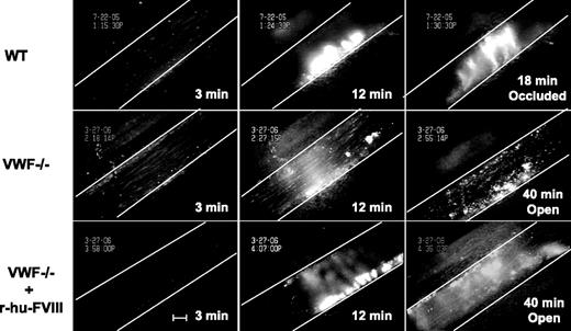 Figure 4. Injured VWF−/− venules do not occlude. Fluorescently-labeled platelets representing approximately 2.5% of total platelets were observed in mesenteric venules of live mice after ferric-chloride injury. Representative photographs of the injured venules are shown. At 3 minutes, the number of single platelets deposited on the injured vessel wall (Figure 1) in the WT mice (top panels) was more than in VWF−/− venules (middle panels) even if the mice were infused with r-hu-FVIII (bottom panels). The thrombus growth was significantly delayed at 12 minutes in the VWF−/− mice with or without r-hu-FVIII when compared with WT. The vessel occluded at 18 minutes in WT, whereas in the VWF−/− mice with or without r-hu-FVIII injured venules remained opened for the entire 40-minute observation time. Blood flow was from left to right. White line delineates the venules, and time after ferric-chloride application is indicated. Bar = 100 μm.