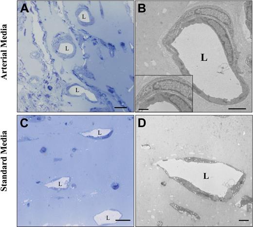 Figure 6. Ultrastructural comparison between the vessel make-up in Matrigel plugs injected with hMAPCs in arterial or standard media. Ultrastructural analysis of Matrigel plugs injected subcutaneously with hMAPCs combined with arterial (A-B) or standard media (C-D). Semithin sections of a Matrigel plug (A,C) and an ultrathin section of an artery-like tube (B) with a detail showing an SMC around an EC (inset) and a veinlike tube (D). “L” indicates the vessel lumen. Scale bars: 10 μm (A,C); 2.5 μm (B); 2 μm (D); 1 μm (B, inset).