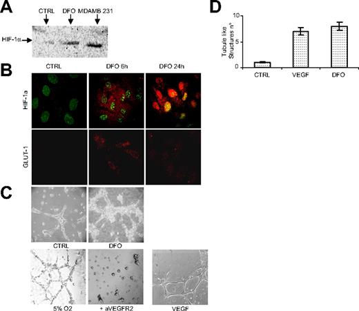 Figure 1. Induction of HIF-1α expression in HUVECs drives angiogenesis. HUVECs were treated with DFO (380 μM) and evaluated for HIF-1α expression by Western blot (A) and confocal (B) analyses. In panel A, the breast carcinoma MDAMB 231 cell line was used as a positive control. In panel B, HIF-1α (in red) colocalizes with nuclear DAPI (pseudo-colored in green; top panels); GLUT-1 staining demonstrated the transcriptional activity of HIF-1α (bottom panels). (C) HUVECs seeded on Matrigel layers in the presence or absence of DFO or hypoxia were analyzed for their capacity to form tubule-like structures. VEGF (10 ng/mL) was used as positive control. The contribution of the VEGF/VEGFR2 autocrine loop to hypoxia-induced tubule formation was assessed by using the blocking anti-VEGFR2 mAb. After 18 hours of incubation, images were captured under a Nikon TS 100 microscope (original magnification ×10), 3 independent experiments were performed, and structures were counted with Lucia software on 3 different fields (D).