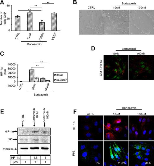Figure 2. Bortezomib exerts double-edged effect on HUVECs, through HIF-1α and NF-kB. HUVECs were treated with bortezomib at 10 nM and 100 nM for 24 hours and then assessed for their proliferative activity (A) or for their ability to form capillaries on Matrigel (B) (original magnification ×10). Data are presented as the mean plus or minus standard error of the mean (SEM) from 3 independent experiments in duplicate in panel A; in panel B one experiment representative of 4 is depicted. (C) Quantification of total (dark column) and nuclear (gray column) HIF-1α expression as calculated by fluorescent pixel intensity at laser confocal microscopy. Data are presented as the mean plus or minus SEM from 20 cells derived from 3 different fields. (D) HIF-1α (green) and GLUT-1expression (red) were assessed in HUVECs treated with bortezomib at 10 nM and 100 nM by confocal analysis (original magnification ×60). Bortezomib up-regulated HIF-1α and NF-kB p65 expression as evaluated by Western blot analysis (E) and induced their nuclear accumulation as evaluated by confocal analysis through merge with DAPI (F) (original magnification ×60). **P < .001.