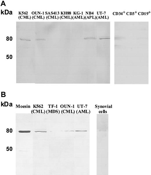 Figure 4. Detection of moesin in the culture supernatant of myeloid leukemia cell lines, CD34+ cells, CD3+ T cells, CD19+ B cells, and synovial cells. (A) Culture supernatants of various myeloid leukemia cell lines, CD34+ cells, CD3+ T cells, and CD19+ B cells were subjected to Western blotting using antimoesin Abs. (B) Exosomal fractions prepared from the culture supernatants of the 4 positive cell lines and synovial cells were also examined by Western blotting.