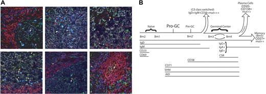 Figure 5. Pro-GC cells that are located in the germinal center. (A) Anti-IgD (red), anti-AID (green), and anti-CD38 (dark blue) were used to stain frozen tonsillar sections. Lymphoid follicles were identified as naive (red), germinal center (green), pre–germinal center (cyan appearance from combination of red, green, and dark blue), and IgD+CD38−AID+ (yellow appearance from combination of red and green). IgD+CD38−AID+ cells are labeled by a white arrow. Six representative sections are shown. (B) Pro-GC cells most likely exist as a transitory population between naive and germinal center cells because of their cell surface and molecular characteristics described here. We propose that pro-GC cells lie at a critical junction in which AID expression and somatic hypermutation (SHM) begin to take place but the cell has not yet matured with a full complement of germinal center surface markers. Because of cell size and the dynamics of CD69 and CD23 expression in the tonsil subpopulations, we place Bm2 prior to Bm1 in this diagram.
