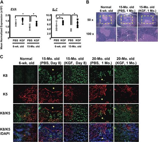Figure 4. KGF treatment normalized intrathymic IL-7 expression, thymic architecture, and TEC organization in aged mice. TEC organization in aged mice was compared 8 days or 1 month after initiation of a single 3-day course of PBS or KGF treatment. (A) Total RNA from whole thymus on day 8 after initiation of PBS or KGF treatment was analyzed for the epithelium-specific transcript EVA and IL-7 by quantitative RT-PCR (n = 5 per group). Each transcript level was normalized to β-actin expression. *P < .05; NS indicates not significant. (B) H&E staining of thymic sections from normal young PBS- or KGF-treated aged mice. (C) Immunofluorescence staining for K5 and K8, and DAPI nuclear staining. The thymus in aged mice displayed indistinct corticomedullary junctions and decreased TEC populations with areas that were completely devoid of keratin-positive TECs (asterisk). KGF treatment normalized TEC organization in aged mice. The magnification was 200 ×.