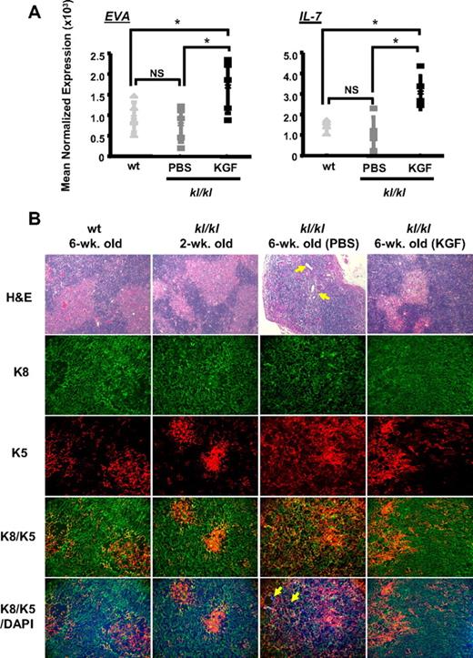 Figure 6. Premature thymic involution in kl/kl mice is related to disruption of thymic microenvironmental organization, which is restored by KGF. (A) The intrathymic levels of EVA, an epithelial cell–specific marker, and IL-7 transcripts in wt littermates or kl/kl mice (2 weeks old, n = 5 per group) were analyzed by quantitative RT-PCR on day 8 after initiation of PBS or KGF treatment. Each transcript level was normalized to β-actin expression. *P < .05; NS indicates not significant. (B)Thymic architecture of wt and kl/kl mice was compared 1 month after PBS or KGF treatment by H&E staining and immunofluorescence staining of K8, K5, and DAPI for nuclear staining. Arrows indicate cysts observed in the kl/kl thymus. The magnification was 100 × for H&E staining and 200 × for immunofluorescence staining.