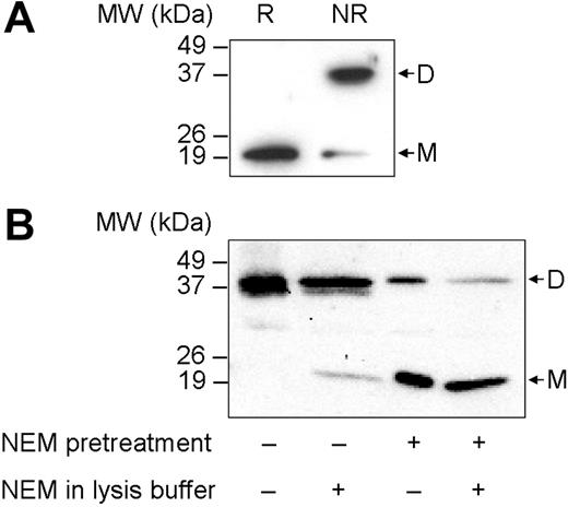 Figure 1. The redox state of Prx2 in erythrocytes. (A) Cells were lysed in SDS-sample buffer, analyzed under reducing (R) or nonreducing (NR) conditions, and immunoblotted with antibodies against Prx2. Molecular weight (MW) markers are indicated on the left. (B) Cells were preincubated with or without 100 mM NEM for 15 minutes, then lysed in nonreducing SDS-sample buffer in the absence or presence of 100 mM NEM. Samples were then immunoblotted for the presence of Prx2. D indicates dimeric Prx2; M, monomeric Prx2.
