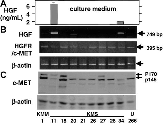 Figure 1. Expression of HGF and c-MET in MM cell lines. (A) HGF concentrations in the culture medium of MM cell lines were examined by ELISA. The mean ± one SD, each in triplicate, is shown. (B) Transcripts of HGF and c-MET were detected by RT-PCR analysis. (C) C-MET expression was examined by Western blot analysis.