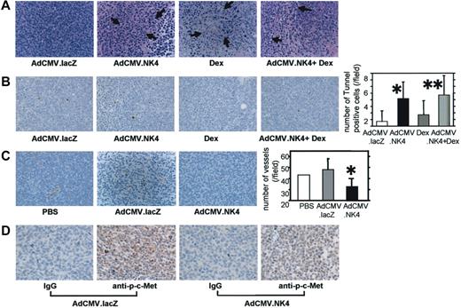 Figure 7. Histopathologic examination of KMS11-derived tumors treated with AdCMV.NK4. (A) Hematoxylin and eosin staining of AdCMV.lacZ-treated, AdCMV.NK4-treated, Dex-treated, and AdCMV.NK4 plus Dex-treated KMS11 tumors. The arrows indicate areas of tumor cell death. (B) TUNEL assay of KMS11 tumors. The numbers of TUNEL+ cells per one visual field (0.148 mm2) were counted and shown in the form of a bar graph. * P = .001, ** P = .008 compared with AdCMV.lacZ-treated tumors. (C) Immunohistochemical analysis of blood vessels in subcutaneous tumors derived from KMS11 cells. Vascular endothelial cells were stained with anti-VWF antibody. The mean number of blood vessels per one visual field is indicated by the bar graph. *P = .029 compared with that in AdCMV.lacZ-treated tumors. (D) Immunohistochemical staining of activated c-Met in AdCMV.NK4-treated tumors using anti–phosphorylated c-MET. To eliminate background staining, human IgG was used as a control. In panels B and C the mean ± 1 SD (n-7 for B and n-5 for C) is shown.