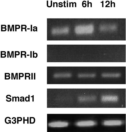 Figure 2. Expression of BMP receptors and Smad1 in human CD4+ T lymphocytes. Human CD4+ T lymphocytes were either untreated or stimulated with anti-CD3 plus anti-CD28 mAbs for the indicated time intervals and RT-PCRs were performed using primers specific for the indicated genes. Primer pair for BMPR-Ib has been confirmed to generate the anticipated product in other cell types (data not shown).