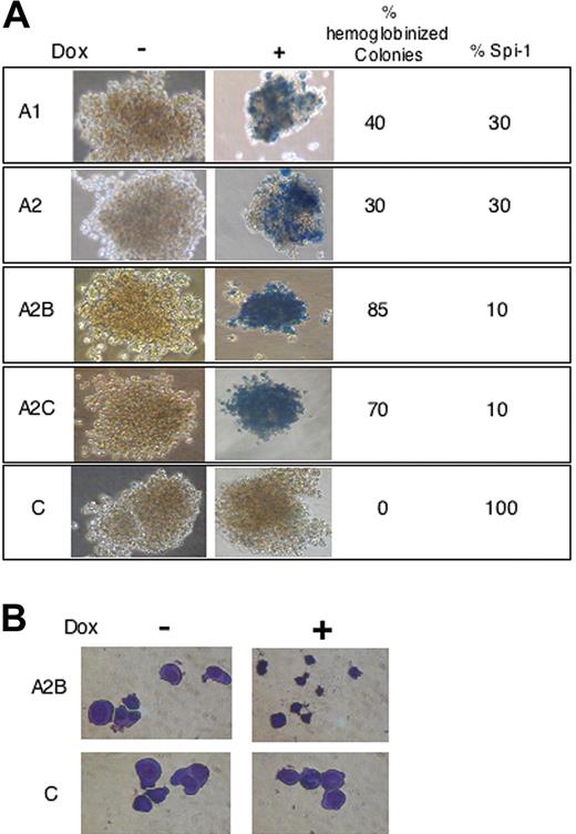 Figure 3. Knock-down of Spi-1 reinitiate erythroid differentiation. (A) Benzidine staining of representative colonies grown in methylcellulose with or without dox for 6 days. The percentage of Spi-1 expression and the percentage of hemoglobinized colonies with dox relative to untreated cells are given. Magnification, × 40. Cells were observed using a Nikon Eclipse TE300 microscope (Nikon, Champigny sur Marne, France) with a 20×/0.45 NA objective lens. Images were acquired with Nikon Coolpix 950 and processed using Adobe Photoshop (Adobe Systems, San Jose, CA) (B) Cytospin smears of A2B and control cells grown during 6 days in methylcellulose with or without dox and stained with May-Grünwald-Giemsa. Images were acquired as in panel A, except a 40×/0.6 NA objective lens was used.