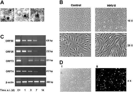 Figure 1. Characterization of HHV-8 acute infection in HUVECs. (A) Electron micrographs of HHV-8 particles produced and purified as described in “Materials and methods” (original magnification, × 50 000; Hitachi H-800 electron microscope; Hitachi, High Technology Europe, Krefeld, Germany). (B) Subconfluent HUVEC monolayers were mock infected (control) or infected with HHV-8 (HHV-8). Microscopic observation of HHV-8 infected HUVECs was performed at 48 hours after infection (a.i.) by a Nikon Eclipse TE2000-S microscope equipped for phase-contrast observation (10×/0.25 and 20×/0.45 NA Fluor objective lenses), using a DS camera head DS-5M and a DS camera control unit DS-L; Nikon). (C) Results of RT-PCR amplification of the indicated HHV-8 genes using RNA extracted from infected cells at different days after infection. β-Actin levels were determined in the same samples as control. Positive controls of amplification of the genes analyzed (C+) are shown. (D) The presence of the HHV-8 late K8.1 protein at 36 hours after infection was detected in HHV-8–infected HUVECs grown onto collagenated culture slides by immunofluorescence analysis using a Nikon Eclipse TE2000-S microscope equipped for fluorescence observation. Immunofluorescence micrograph (ii) and the corresponding bright-field image (i) are shown at original magnification × 4 (pictures were taken with a 4×/0.13 NA Fluor objective). All images were processed by Nero Photosnap Viewer 7 (Nero ACT, Karlsbad, Germany). Under the conditions described, approximately 20% of cells were positive for the K8.1 protein.