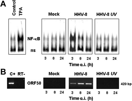 Figure 3. HHV-8 replication is required for NF-κB induction in HUVECs. HUVECs were mock infected (mock), infected with HHV-8 or UV-inactivated HHV-8 (HHV-8 UV), or treated with TPA (20 ng/mL). At different times after infection, whole-cell extracts were prepared and assayed for NF-κB activation by EMSA. (A) Sections of fluorograms from native gels are shown. Position of NF-κB-DNA (NF-κB) and nonspecific protein-DNA (ns) complexes are indicated. (B) Results of RT-PCR amplification of the HHV-8 ORF50 gene using RNA extracted from mock-infected (mock), HHV-8–infected, or UV-inactivated HHV-8–infected cells. Positive control of ORF50 amplification (C+) and control for DNA contamination, performed by direct amplification of RNA without retrotranscription (RT−) are shown.