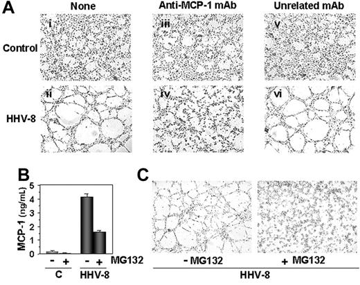 Figure 6. HHV-8 acute infection induces MCP-1–dependent capillary-like structure formation. Mock-infected (control) and HHV-8–infected HUVECs were harvested 24 hours after infection and plated on BME (5 × 104 cell/well). Cells were incubated at 37°C in complete medium (i-ii) or medium containing 1 μg/mL anti–MCP-1 mAb (iii-iv), or unrelated mAb (v-vi). After 4 hours cells were observed by optical microscopy (Leica DM IRB, Wetzlar, Germany) and photographed with CCD optics (Hitachi Denshi Color Camera KP-D50E/K; Rodgau, Germany) using a digital analysis system (QWIN LITE version 2.3; Leica). Tubelike structure formation is evident in HHV-8–infected cells (compare panels i and ii). The addition of anti–MCP-1 antibody completely blocks the formation of capillary-like structures in HHV-8–infected HUVECs (compare panels ii and iv), whereas the unrelated mAb has no effect (compare panels iv and vi). Photographs (4×/0.10 NA Plan objective lens) from a representative experiment of 3 with similar results are shown; mAb indicates monoclonal antibody. (B) HUVECs were treated with 5 μM MG132 (carbobenzoxy-l-leucyl-l-leucyl-l-leucynal; Sigma-Aldrich; +) or control diluent (−). After 1 hour, cells were infected with HHV-8 or mock infected (C) and incubated in the presence or absence of MG132. At 4 hours after infection, MCP-1 levels in culture supernatants were determined by ELISA. Data represent the mean ± SD of triplicate samples. (C) In a parallel experiment, HHV-8–infected HUVECs were cultured in the presence (+) or absence (−) of MG132 (1 μM) for 24 hours, and then plated on BME (5 × 104 cell/well) in fresh medium in the absence of MG132. Cells were observed under microscope for capillary-like structure formation at 4 hours after seeding. Photographs (original magnification × 40) from a representative experiment are shown. MG132 treatment during infection completely prevented endothelial cell alignment and tubule formation.