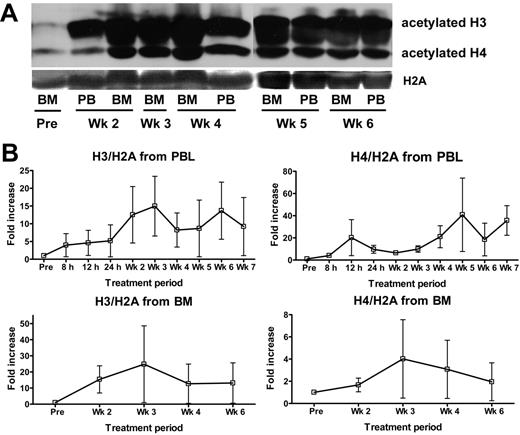 Figure 1. In vivo effects of MS-275 on histone acetylation as determined by Western blotting. (A) Serial analysis of histone acetylation in BMMCs and PBMCs of patient 26 treated at DL 4 as determined by Western blotting using antibodies against acetyl-histone H3 and acetyl-histone H4. Histone H2A served as a control protein. (B) Serial PBMCs and BMMCs from 9 patients treated at DL 4 (n = 8) and 5 (n = 1) were analyzed by Western blotting for histone acetylation as described above. Intensity index was calculated as a ratio of intensity of acetylated histone H3 or H4 band to band intensity of nonacetylated H2A as determined by Western blot analysis using antibodies against acetyl-histone H3, acetyl-histone H4, and histone H2A and expressed as fold increase ± SEM over the baseline value.