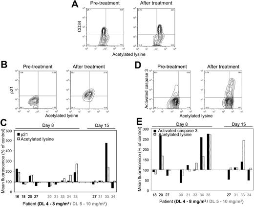 Figure 2. MS-275–induced increase in protein acetylation correlates with increase in p21 expression and caspase-3 activation in BMMCs as determined by flow cytometry. (A) Protein hyperacetylation versus CD34 expression before and after MS-275 (day 8, patient 38, DL 5). Note that in this patient all of the CD34+ cells became hyperacetylated but not all of the CD34− cells. (B) Protein hyperacetylation versus p21 expression in BMMCs before and after MS-275 (day 15, patient 33, DL 5). (C) Comparison in individual patients of the effect of MS-275 on protein hyperacetylation and p21 expression in BMMCs. (D) Protein hyperacetylation versus caspase-3–activated form expression in BMMCs before and after MS-275 (day 8, patient 20, DL 4). (E) Comparison in individual patients of the effect of MS-275 on protein hyperacetylation and caspase-3 activation in BMMCs. Correlations were performed in at least 7000 individual cells by multiparameter flow cytometry using a FACSCalibur flow cytometer (Becton Dickinson).