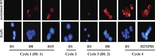 Figure 3. MS-275–induced histone H3 hyperacetylation in BMMCs. Changes in histone acetylation were monitored sequentially in BMMCs by staining with polyclonal antiacetylated histone H3 antibody (top) and counterstaining with 4,6-diamidoino-2-phenylindole (DAPI; bottom). The images were collected with a Zeiss Axioskop fluorescence microscope (Carl Zeiss, Oberkochen, Germany) equipped with a Hamamatsu C4742-95 camera (Hamamatsu Photonics, Hamamatsu City, Japan) and a Zeiss 63×/1.25 NA oil-immersion objective lens, and were processed with Openlab Software version 4.0.4 (Improvision, Lexington, MA). Note increase in histone H3 acetylation in patient 2 treated at DL 1 for first 2 cycles and at DL 2 for last 2 cycles. Increase in histone H3 acetylation was observed at day 8 and persisted through subsequent cycles.