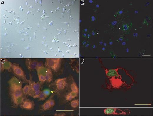 Figure 5. Engulfment of apoptotic or necrotic ECs by HMEC-1 cells and HUVECs. (A) Exposure of HMEC-1 cells to necrotic HMEC-1 cells for 3 hours resulted in engulfment of labeled cell fragments. (B) After 6 hours of coincubation phagocytosed particles appear in the lysosomes around the nucleus (arrows). (C) CM-Dil labeled HMEC-1 cells were incubated with CMFDA-labeled apoptotic HMEC-1 cells. After 1 hour apoptotic cells were engulfed by HUVECs (white arrowheads). The yellow arrow indicates an apoptotic cell that binds to the surface of a HUVEC. (D) CM-Dil stained HUVECs were exposed for 2.5 hours to apoptotic HMEC-1 cells. The micrograph shows a confocal image of a cell engulfing an apoptotic (green) cell. A cross-section of the whole cell is shown in the micrograph at the bottom. Bars represent 50 μm (A-C) or 20 μm (D).