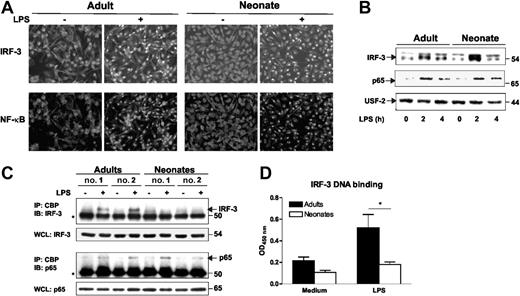 Figure 5. Impaired interaction of IRF-3 and CBP in neonatal moDCs. (A-B) Analysis of IRF-3 and NF-κB p65 translocation in adult and cord blood moDCs. (A) Cells were incubated in the presence of medium (unstimulated) or LPS (100 ng/mL) for 2 hours, fixed, and stained for IRF-3 (Alexa 488, green), p65/RelA (Alexa 568, red). Representative fields of IRF-3 and p65 fluorescence from 5 adults and 6 neonates are shown. (B) Nuclear translocation of IRF-3 and p65 were analyzed by Western blotting as described in “Material and methods.” One representative adult and cord blood sample of 3 are shown. (C) Impaired interaction of IRF-3 with CBP in LPS-stimulated cord blood moDCs. Coimmunoprecipitation experiments were performed as described in “Material and methods.” The asterisk (*) denotes IgG. Two representative adult and cord blood samples of 6 are shown. (D) Assessment of IRF-3 DNA-binding capacity in adult and cord blood moDCs. Cells were left untreated or stimulated for 2 hours with LPS. Nuclear extracts were isolated, and IRF-3 DNA-binding activity was measured using TransAM transcription factor assay kit. Results are presented as mean and SEM from at least 5 different donors. *P <.05 as compared with adult moDC.