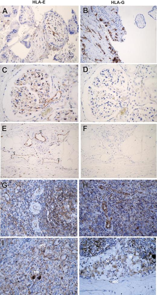 Figure 1. Immunoperoxidase staining showing HLA-E expression in human normal tissues. (A) Comparative staining for HLA-E (i, iii, v) and HLA-G (ii, iv, vi) in paraffin-embedded sections of human first-trimester trophoblast (i-ii) and kidney (iii-vi). (B) Comparative expression of HLA-E protein was studied in paraffin-embedded sections of human spleen (i-ii) and lymph node (iii-iv). Arrowheads indicate ECs, M, macrophages; MK, megakaryocytes; and sEC, sinusoidal ECs. Original magnification, ×400. Images were visualized under an Olympus BX50F4 microscope (Olympus Optical, Tokyo, Japan) equipped with 4×/0.13, 10×/0.30, 20×/0.50, and 40×/0.75 objective lenses and an Olympus Camedia C-4040Zoom camera; Olympus DP-Soft version 3.2 software was used to acquire and process images.