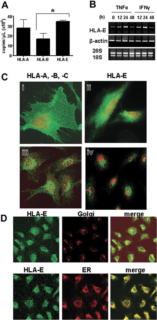 Figure 2. HLA-E mRNA and protein expression in cultured human ECs. (A) Quantification and comparative analysis of mRNA steady state levels for HLA-A, HLA-B, and HLA-E in cultured ECs by competitive RT-PCR. Values are mean ± SD (n = 3). *P < .01 versus HLA-B. (B) Regulation of HLA-E mRNA in response to TNFα or IFNγ was assessed by semiquantitative RT-PCR. PCR amplifications for β-actin were used as controls. RNA 18S and 28S are shown below. (C) Confocal microscope images showing comparative cell-surface staining for HLA-A, HLA-B, HLA-C (i, ii) and HLA-E (ii, iv) on nonpermeabilized (i-ii) and permeabilized (iii-iv) vascular ECs. Nuclei were stained with To-pro-3 (red). (D) The colocalization of HLA-E (left panel; green) rhodamine-B-hexyl ester (for ER staining) or anti–golgin-97 (for Golgi staining, both middle panel; red) on permeabilized ECs. Merged images are shown on the right panel. Colocalization is shown in yellow. Original magnification, ×63. Scale bar equals 15 μm (applies to all figures).