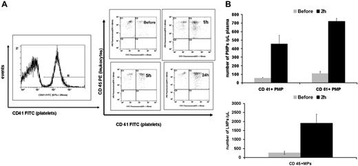 Figure 3. Adenovirus induces platelet-leukocyte aggregate formation and both platelet and leukocyte MPs following intravenous administration to mice. (A) Whole blood samples obtained from Balb/c mice during the first 24 hours following injection of adenovirus. Flow cytometry assessment of platelet-leukocyte aggregate was performed as follows: platelets were first gated based on the CD41 marker and the percentage of CD45+ cells (leukocytes) associated with platelets was assessed on another histogram. The upper right quadrants of the histograms show an evolving significant increase in platelet-leukocyte aggregates from before to various time points following adenovirus treatment. These data are representative of 3 independent in vivo experiments. (B) Graphs showing the average number of MPs in plasma obtained from Balb/c mice based on separate assessment of CD41 and CD61 (PMPs) and CD45 (LMPs). There is a significant increase in PMPs (n = 3, P = .02 based on CD41; P < .001 based on CD61 marker) and LMPs (n = 3, P = .03) at 2 hours following virus administration compared to the preinjection levels (Before). Values shown are the mean ± SEM.