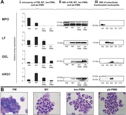 Figure 1. ARG1 is synthesized in myelocytes/metamyelozytes and stored in gelatinase granules of mature neutrophils. (Ai) Populations highly enriched in promyelocytes (PMs), myelocytes/metamyelocytes (MYs), bone marrow neutrophils (bm-PMNs), and peripheral blood neutrophils (pb-PMNs) were isolated from bone marrow (BM) and peripheral blood (PB) samples collected from healthy persons. Total mRNA was isolated and subjected to microarray analysis to monitor the mRNA expression profiles for ARG1, myeloperoxidase (MPO; marker for azurophilic granules), lactoferrin (LF; marker for specific granules), and gelatinase (GEL; marker for gelatinase granules) during granulocytic differentiation (mean ± SD, n = 3). (Aii) Western blot analysis of BM and PB populations using antibodies against MPO (proform 89 kDa and heavy chain 64 kDa), LF (78 kDa), GEL (92 kDa), and arginase 1 (ARG1; 35 kDa). Lysates of 3 × 105 cells were loaded in each lane. (Aiii) Subcellular fractions, highly enriched in azurophilic granules (AGs), specific granules (SGs), gelatinase granules (GGs), secretory vesicles (SVs), and cytosol (CYT) were isolated from 108 cells and subjected to Western blot analysis (Aii). (B) Wright Giemsa stained cytospins of BM and PB populations were examined under a BX51 microscope equipped with a DP70 photosystem with analySIS 5.0 software (Olympus, Hamburg, Germany) and a 40×/0.85 numeric aperture oil objective. PowerPoint (Microsoft, Redwood, WA) was used to prepare the images.