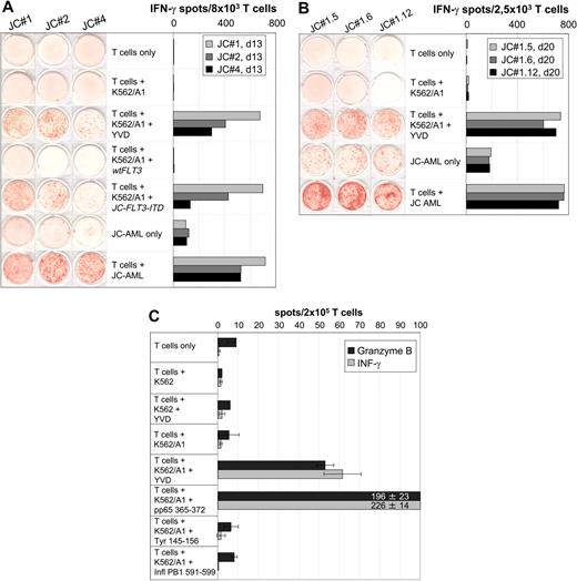 Figure 2. AML-reactive CD8+ T cells of patient J.C. specifically recognized the HLA-A*0101–restricted peptide YVDFREYEYY (YVD/A1) encoded by JC-FLT3-ITD. (A) Specificity of IVS-responder populations. JC-PBMCs collected in CR after induction chemotherapy were stimulated with peptide YVD/A1 in independent IVS. IVS responders were tested on day 13 in a 20-hour IFN-γ ELISPOT assay for recognition of unloaded, YVD/A1-loaded, wtFLT3 mRNA–transfected, or JC-FLT3-ITD mRNA–transfected K562/A1 cells (1 × 105 per well) as well as for recognition of autologous AML cells (1 × 105 per well). The results obtained with IVS JC#1, JC#2, and JC#4 are shown as representative examples. (B) Specificity of T-cell clones derived from IVS JC#1. JC#1 responders were cloned on day 14 by limiting dilution using HLA-I–compatible EF-DCs transfected with JC-FLT3-ITD mRNA as stimulators. T-cell clones were tested 20 days later against unloaded or YVD/A1-loaded K562/A1 cells (1 × 105 per well) as well as against autologous AML cells (1 × 105 per well) in a 20-hour IFN-γ ELISPOT assay. Three representative clones, JC#1.5, JC#1.6, and JC#1.12, are shown. (C) Reactivity against YVD/A1 detectable in ex vivo CD8+ T cells. CD8+ T cells were positively selected from JC-AML cells with immunomagnetic beads (Miltenyi Biotec, Bergisch Gladbach, Germany) and tested in a 30-hour IFN-γ and in a 30-hour GrB ELISPOT assay against unloaded or peptide-loaded untransfected K562 cells (1 × 105 per well) as well as against unloaded or peptide-loaded K562/A1 cells (1 × 105 per well). Peptides were YVD/A1- and known HLA-A1–binding peptides from HCMV pp65, tyrosinase, and influenza A basic polymerase 1 (pp65 364 to 373, SEHPTFTSQY; tyrosinase 146 to 156, SSDYVIPIGTY; PB1 591 to 599, VSDGGPNLY, respectively). The pp65 peptide served as a positive control; tyrosinase and influenza A peptides were negative controls. Data are means of duplicates. Notably, YVD/A1 recognition required the presence of HLA-A1 on K562 cells, because peptide-loaded but untransfected K562 cells did not induce spot formation in any test.