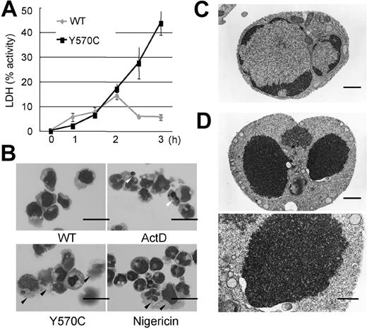 Figure 2. Distinctive features of cell death after Y570C transfection. (A) LDH release from damaged cells, as a percentage of total intracellular LDH content, which was set as 100%. The amount of LDH released into the culture supernatant from Y570C-transfected cells was significantly more than that released by WT-CIAS1–transfected cells. Error bars indicate SD (n = 3). (B) Cytospin preparations stained with Giemsa of the indicated cell populations and observed by inverted microscopy using an Olympus BX51 microscope (Olympus, Tokyo, Japan) equipped with a 40×/0.85 objective lens, an Olympus DP70 camera, and DP-controller version 1.1 software. Cells treated with 1 μg/mL actinomycin D (ActD) showed typical nuclear condensation with the formation of apoptotic bodies (white arrowheads), and slight cytoplasmic shrinkage. Some of the nuclei in nigericin-treated cells were swollen and stained weakly with Giemsa. In addition, nigericin-treated cells had larger cytoplasms, and were easily destroyed by the cytospin preparation process (black arrowheads). In Y570C-transfected cells, obvious nuclear condensation and formation of apoptotic bodies was rare, and their phenotypic appearance was similar to nigericin-treated necrotic cells. The scale bar represents 20 μm. (C) Electron microscopy of WT-CIAS1–transfected cells. The scale bar represents 1 μm. (D) Electron microscopy of Y570C-transfected cells revealed loss of the nuclear membrane cavity, and fusion of chromatin with the cytosol, as well as obscured structures of cytosolic organelles. The top scale bar represents 1 μm; the bottom scale bar represents 500 nm. Representative data from 3 independent analyses of similar results are shown.