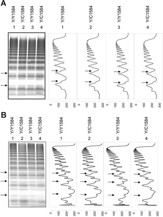 Figure 1. Multimer analysis of VWF from Y/Y1584 and Y/C1584 donors. (A) 1.4% (wt/vol) agarose gel. (B) 2.0% (wt/vol) agarose gel. Lanes 1 to 4 in each panel contain plasma VWF from 2 donors of each phenotype. (left) Multimer gel. (right) Densitometric scans of all lanes of the gel. A subtle but highly reproducible decrease in the upper satellite triplet band in heterozygous VWF was visible on the multimer gel and in the densitometric scans (arrows). This difference may extend to higher multimers but was beyond the resolution of the gel. The scale at the base of each scan corresponds to color intensity: 0 = black; 300 = white.