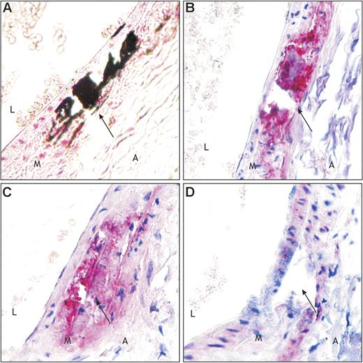 Figure 3. Effect of W&K treatment (3 mg/g warfarin and 1.5 mg/g vitamin K1) on the presence of calcification and MGP at the 12-week time point. Sections were prepared as described in the legend of Figure 2. Longitudinal sections of each thoracic aorta were stained with von Kossa (A) and immunohistochemically with anti–t-MGP (B), anti-ucMGP (C), and anti-cMGP (D) (see “Materials and methods” for details). It is clearly demonstrated that because of the W&K diet arterial calcification was significantly present. In panel B total MGP is up-regulated in the calcified area. From panel D it can be seen that cMGP is almost absent, whereas significant amounts of the inactive ucMGP are present around the calcified area (C). Arrow indicates same area. Red stain indicates MGP, black stain indicates calcium, and blue indicates cell nuclei. Magnification, × 400. A indicates adventitia; M, media; and L, lumen. Details of image acquisition are provided in the legend of Figure 2.
