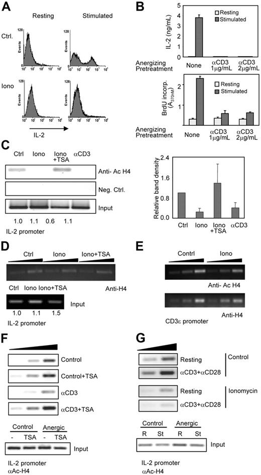 Figure 2. Anergizing stimuli induce H4 deacetylation of the il2 promoter in anergic Th1 cells. (A) Th1 cells were treated with 1 μM ionomycin (Iono) for 16 hours and analyzed by intracellular IL-2 staining following stimulation with anti-CD3 and anti-CD28. (B) Th1 cells were anergized with plate-bound anti-CD3 and, after a 3-day resting period, stimulated with anti-CD3 and anti-CD28. IL-2 expression (ELISA) and BrdU incorporation were measured. Error bars show mean ± SEM of 3 experiments. (C) ChIP assays were performed with antiacetylated H4 antibodies to assess acetylation of the il2 promoter. Control cells were analyzed and compared with cells anergized using either ionomycin (Iono) or anti-CD3. In some cells, TSA (10 nM) was added together with ionomycin to inhibit the activity of HDACs. Experiments were also performed with a control IgG. PCR products are shown for precipitated fractions and sample inputs. One experiment of 4 is shown. Numbers below input bands indicate relative amount (to control cells) quantified using qPCR. Graph shows relative intensity of immunoprecipitated complexes from all experiments (mean + SEM). (D) ChIP experiments were performed in control (Ctrl) and anergized (Iono) cells (± TSA) using anti-H4 antibodies. PCR reactions were carried out with different amounts of sample (2-fold increases) to confirm linearity of the amplification. (E) Samples from panels C and D were also analyzed using primers for the CD3ϵ promoter. (F) Th1 cells were anergized by stimulation with anti-CD3 for 16 hours in the presence or the absence of TSA, washed, and left resting for 3 days. After that, ChIP assays were performed using antiacetylated H4 antibodies and primers specific for the IL-2 promoter. The gels show PCR amplifications of 3 different amounts of chromatin (2-fold increases) for the anti-CD3–treated and control cells. PCR amplifications of the inputs from the different samples are also shown. (G) Control cells or cells anergized with ionomycin were restimulated with anti-CD3 and anti-CD28 for 6 hours and then used to immunoprecipitate chromatin complexes using an antiacetylated H4 antibody. Amplified products from different amounts of each sample (2-fold increases) and from the different inputs are shown.