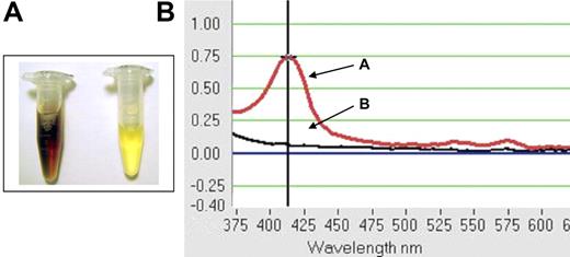 Figure 5. Gross hemoglobinuria in wild-type C57BL/6 mice following passive immunization with the IgM E4 anti-hGPA mAb and transfusion with incompatible hGPA-Tg-mRBCs. Mice were passively immunized intravenously with 100 μg of the purified IgM E4 mAb. (A) Representative posttransfusion urine samples were obtained at autopsy from mice receiving incompatible hGPA-Tg-mRBCs (left sample) or receiving compatible wild-type mRBCs (right sample). (B) Urine samples from mice transfused with incompatible hGPA-Tg-mRBCs displayed absorbance peaks at 414 nm (eg, curve A); no absorbance peak at 414 nm was detectable in any urine sample obtained from mice transfused with compatible wild-type mRBC (eg, curve B).
