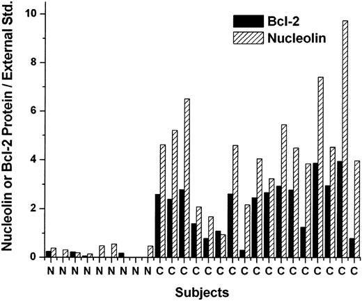 Figure 1. Overexpression of nucleolin and bcl-2 proteins in CLL cells compared with normal B cells. Peripheral-blood lymphocytes were isolated from CLL patients and healthy volunteers by density gradient centrifugation and the B cells were purified by positive selection with magnetic-activated cell separation (MACS) CD19+ immunomagnetic beads. Nucleolin and bcl-2 protein levels were measured in S10 extracts of the cells by Western blotting. The results were normalized to the values obtained from known amounts of nucleolin and bcl-2 protein external standards. The labels N and C along the X-axis refer to normal B cells and CLL cells, respectively, from individual subjects.
